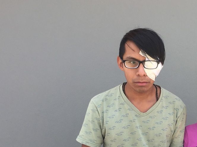 Pierde un ojo tras ataque homofóbico; autoridades investigan negligencia policíaca