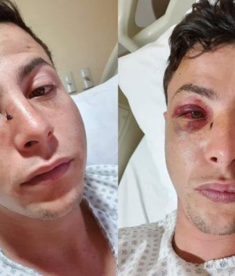 Homofobia: Atacan con violencia a jóvenes en Guadalajara, uno de ellos, narra la agresión