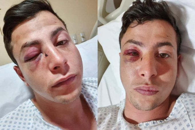 Homofobia: Atacan con violencia a jóvenes en Guadalajara, uno de ellos, narra la agresión