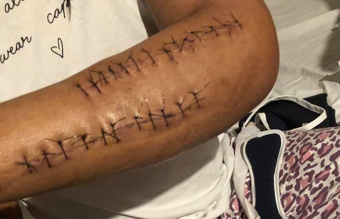 Transfobia en Durango: Fernanda es atacada brutalmente por 15 hombres